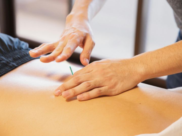 dry needling for chronic pain near me
